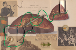 Rhapsody in Spleen by Frank Turek